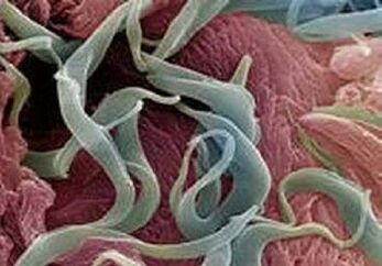 Symptome und Behandlung von Parasiten im menschlichen Körper