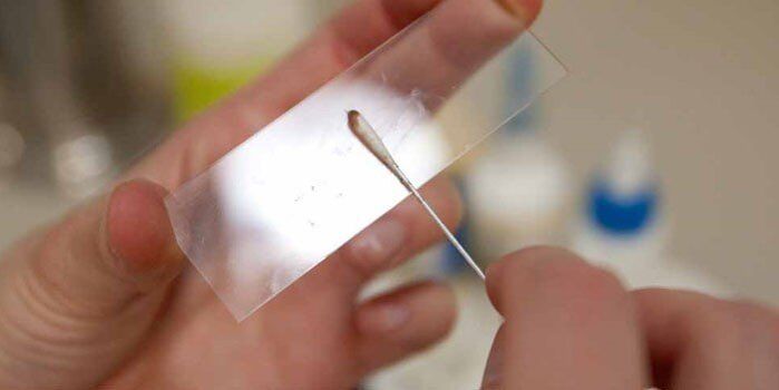 Hautabkratzung auf Parasiten